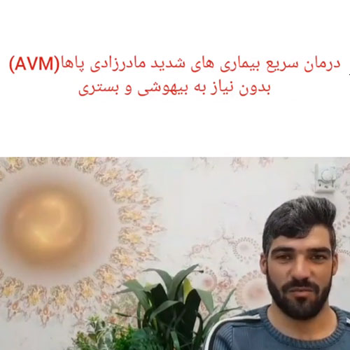 title="بیماری مادرزادی پاها (AVM) | کلینیک فوق تخصصی درمان واریس در اصفهان"
